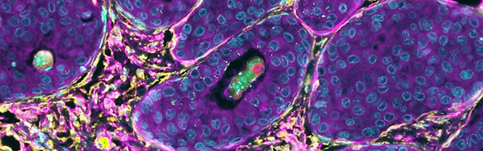 This image was taken by Karla Esbona from the TRIP lab during some spatial & molecular profiling work.